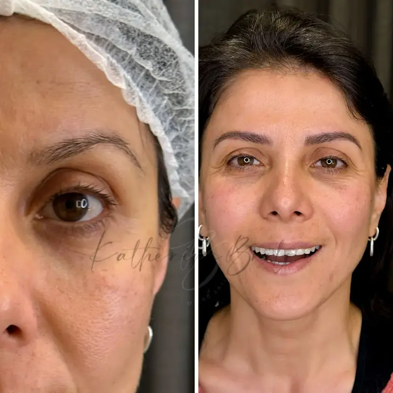 Microblading Barcelona efecto cejas — Katherine Brito